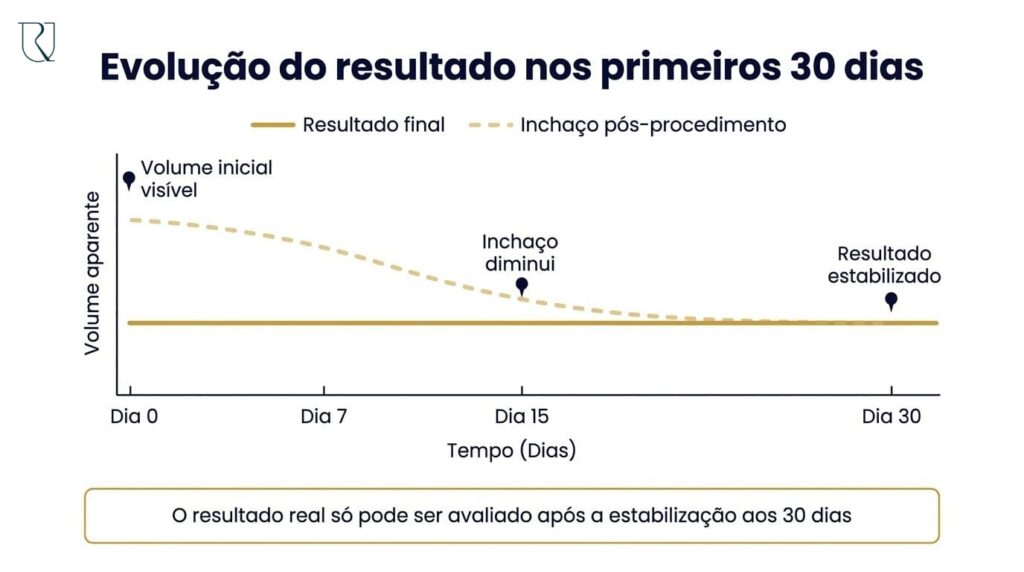 preenchimento peniano com acido hialuronico dr rafael correia urologista brasilia harmonização intima bioplastia peniana engrossamento peniano aumento peniano