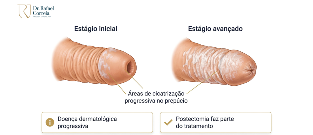 Paciente recebendo orientações sobre cirurgia para correção da fimose.
