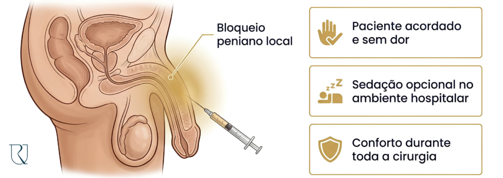 Atendimento urológico para homens com indicação de postectomia.