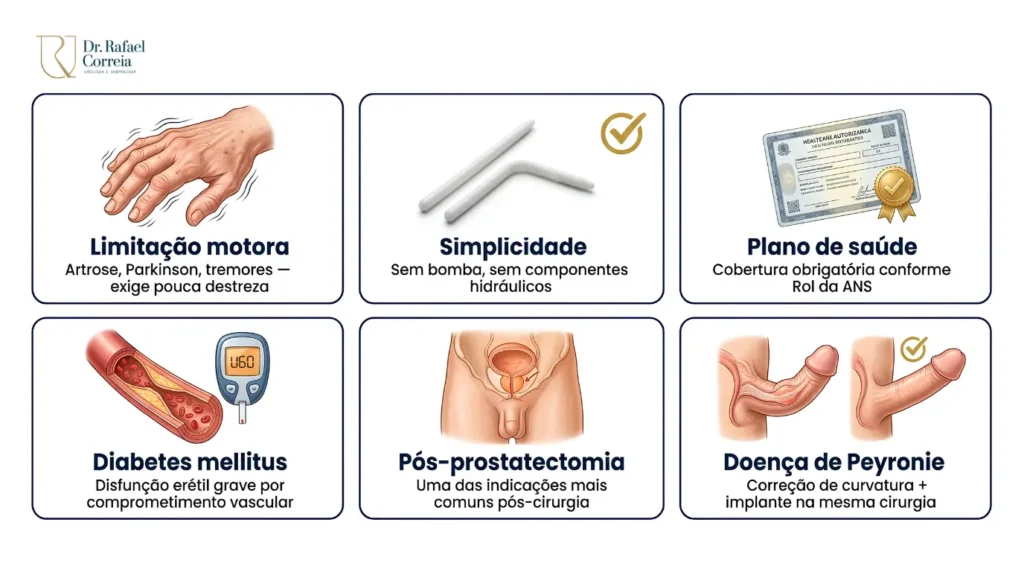 Ilustração médica sobre corpos cavernosos relacionada à prótese peniana semirrígida para tratamento da disfunção erétil.