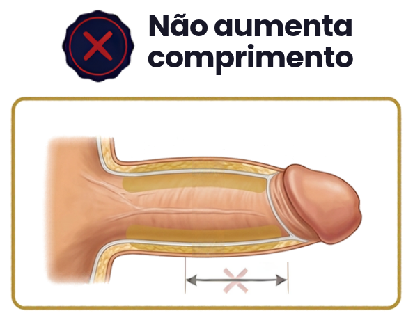 Diferença entre engrossar e alongar o pênis